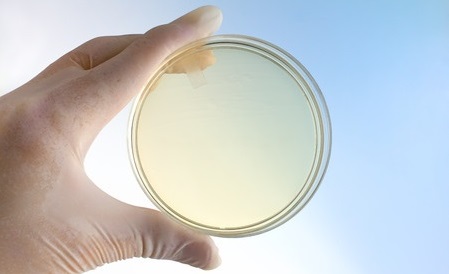 37543212 - hand of microbiologist holding petri dish at background blue and white / scientist with a hand holding a petri dish